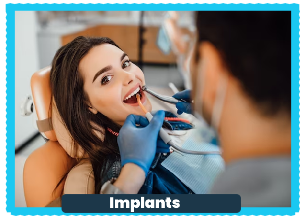 Implants