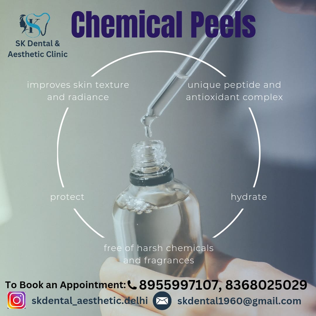 Chemical Peel Treatment