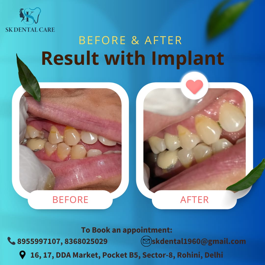 Dental Implant Clinic